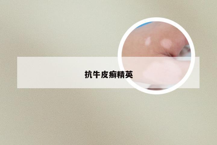 抗牛皮癣精英