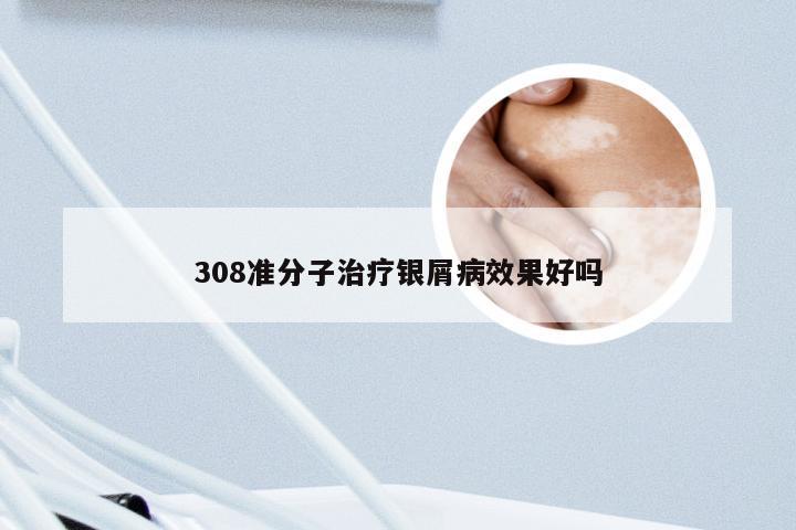 308准分子治疗银屑病效果好吗