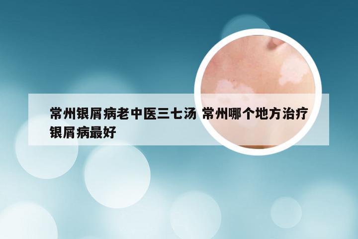 常州银屑病老中医三七汤 常州哪个地方治疗银屑病最好