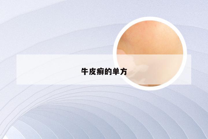 牛皮癣的单方