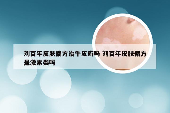 刘百年皮肤偏方治牛皮癣吗 刘百年皮肤偏方是激素类吗