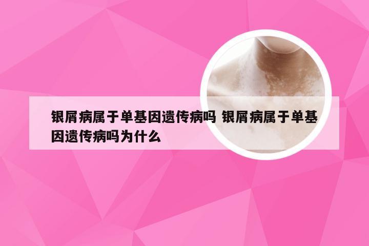 银屑病属于单基因遗传病吗 银屑病属于单基因遗传病吗为什么