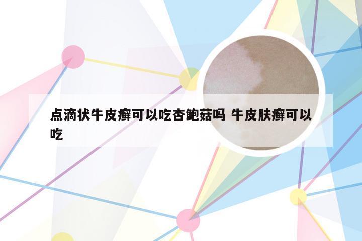 点滴状牛皮癣可以吃杏鲍菇吗 牛皮肤癣可以吃
