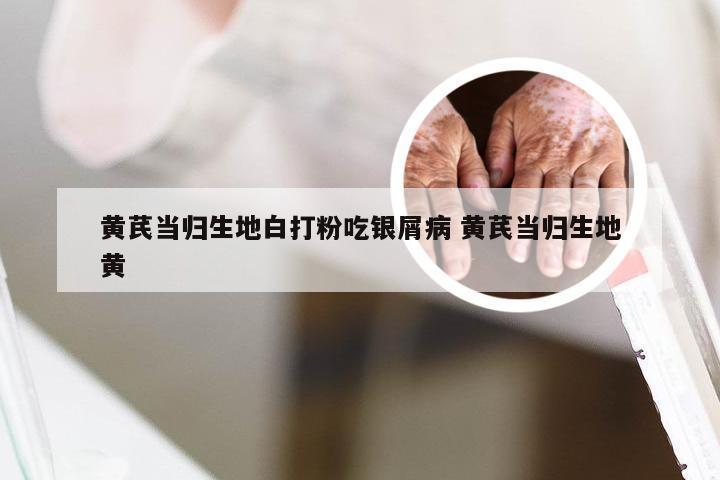 黄芪当归生地白打粉吃银屑病 黄芪当归生地黄