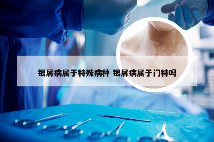 银屑病属于特殊病种 银屑病属于门特吗