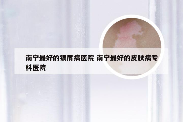 南宁最好的银屑病医院 南宁最好的皮肤病专科医院