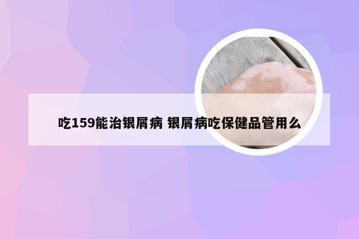 吃159能治银屑病 银屑病吃保健品管用么