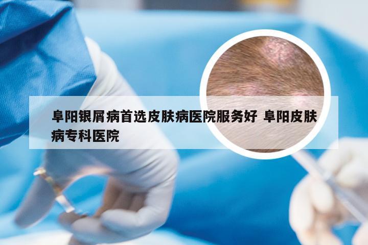 阜阳银屑病首选皮肤病医院服务好 阜阳皮肤病专科医院