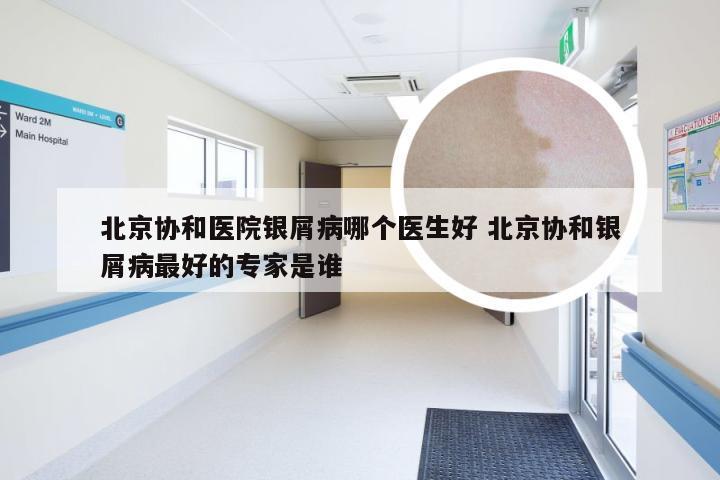 北京协和医院银屑病哪个医生好 北京协和银屑病最好的专家是谁