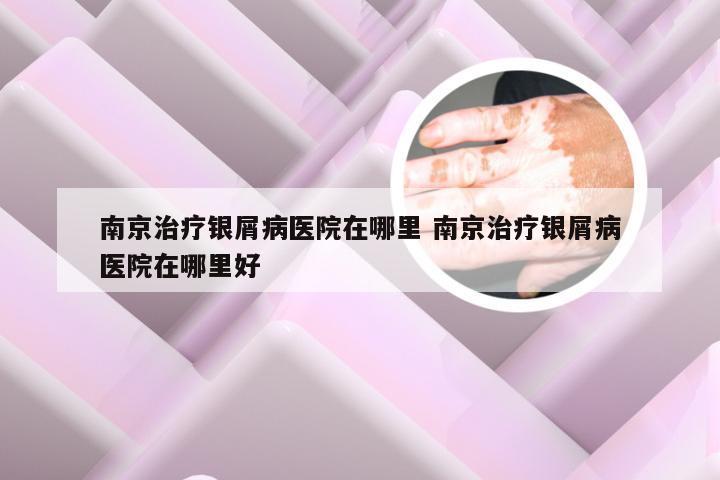 南京治疗银屑病医院在哪里 南京治疗银屑病医院在哪里好