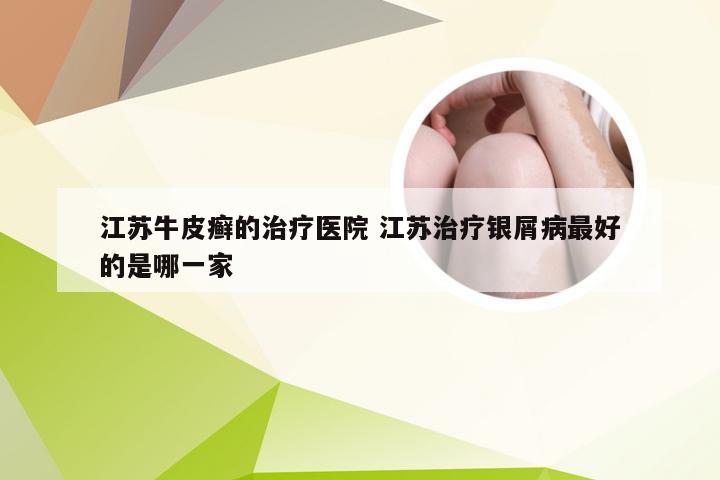 江苏牛皮癣的治疗医院 江苏治疗银屑病最好的是哪一家