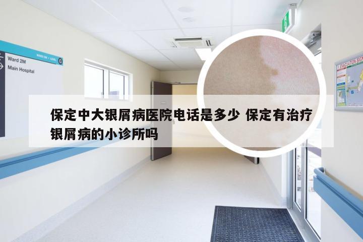 保定中大银屑病医院电话是多少 保定有治疗银屑病的小诊所吗