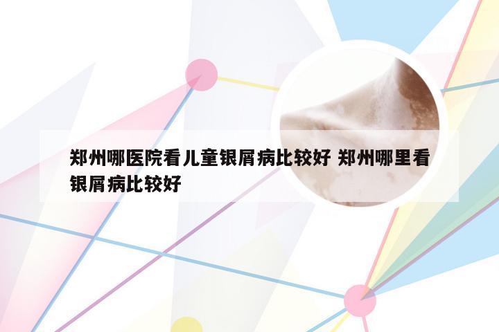 郑州哪医院看儿童银屑病比较好 郑州哪里看银屑病比较好