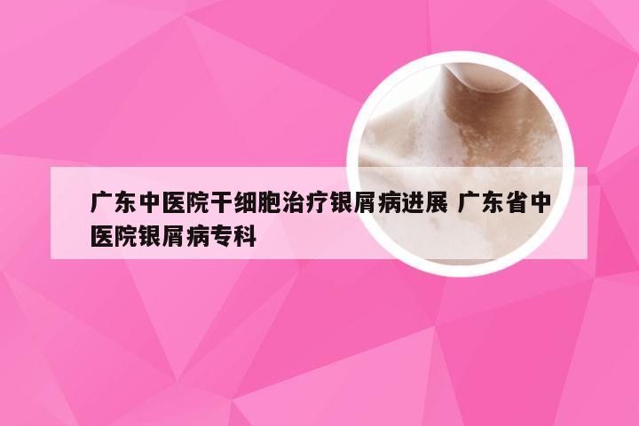 广东中医院干细胞治疗银屑病进展 广东省中医院银屑病专科