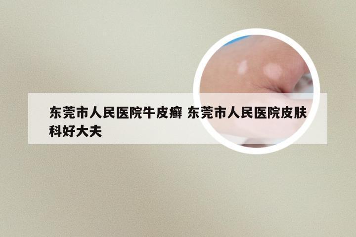 东莞市人民医院牛皮癣 东莞市人民医院皮肤科好大夫