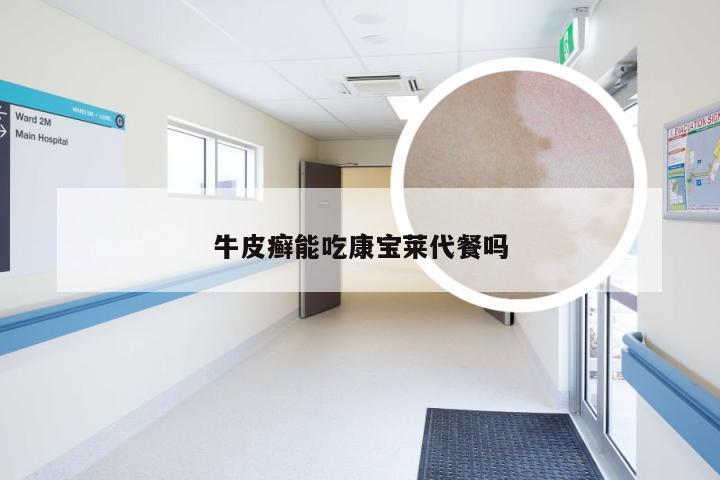 牛皮癣能吃康宝莱代餐吗