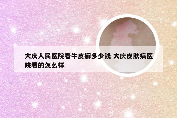 大庆人民医院看牛皮癣多少钱 大庆皮肤病医院看的怎么样
