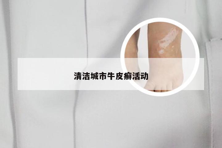 清洁城市牛皮癣活动