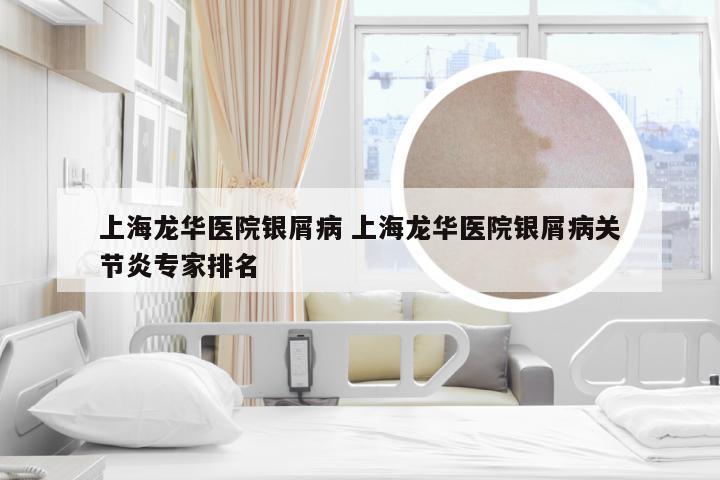 上海龙华医院银屑病 上海龙华医院银屑病关节炎专家排名
