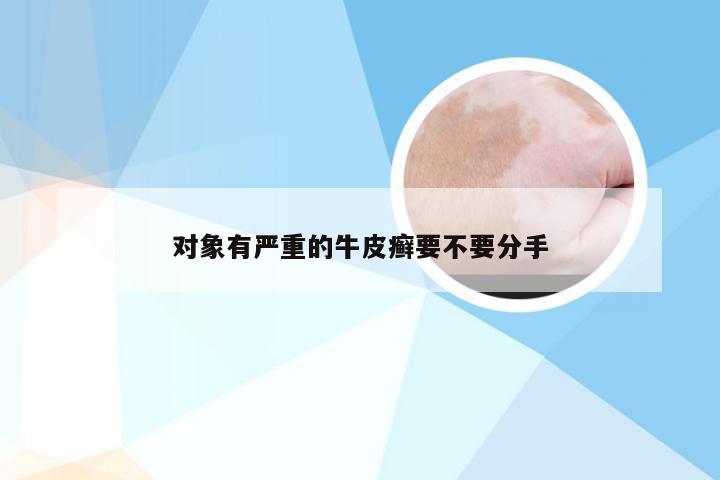 对象有严重的牛皮癣要不要分手