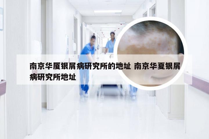 南京华厦银屑病研究所的地址 南京华夏银屑病研究所地址