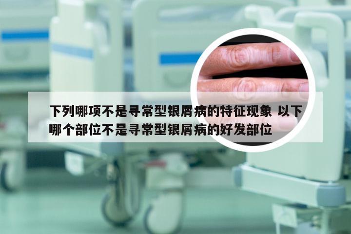 下列哪项不是寻常型银屑病的特征现象 以下哪个部位不是寻常型银屑病的好发部位