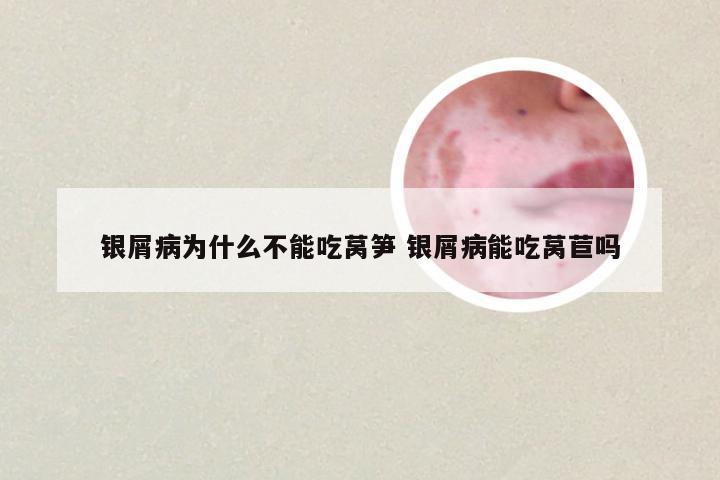 银屑病为什么不能吃莴笋 银屑病能吃莴苣吗