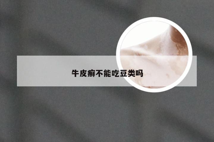 牛皮癣不能吃豆类吗