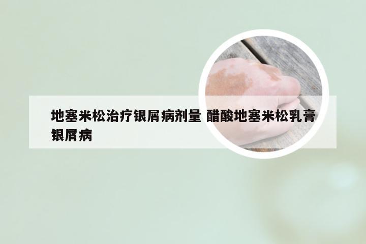 地塞米松治疗银屑病剂量 醋酸地塞米松乳膏银屑病