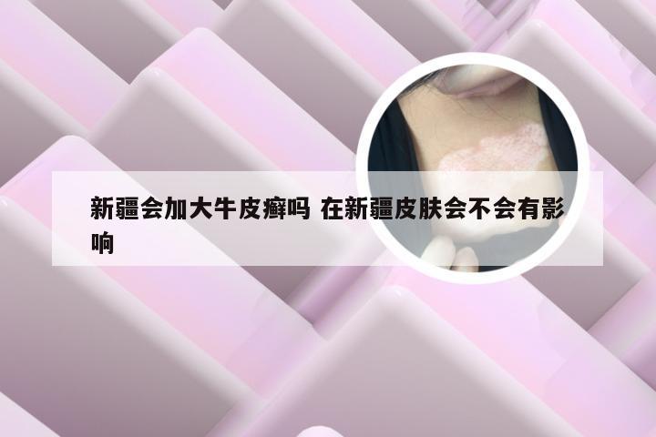 新疆会加大牛皮癣吗 在新疆皮肤会不会有影响