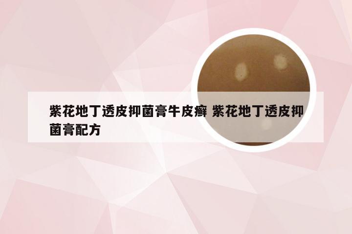 紫花地丁透皮抑菌膏牛皮癣 紫花地丁透皮抑菌膏配方
