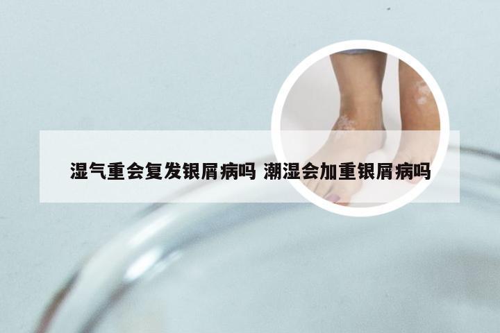 湿气重会复发银屑病吗 潮湿会加重银屑病吗