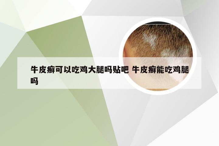 牛皮癣可以吃鸡大腿吗贴吧 牛皮癣能吃鸡腿吗