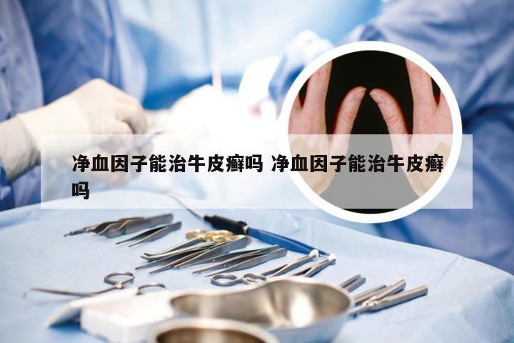 净血因子能治牛皮癣吗 净血因子能治牛皮癣吗