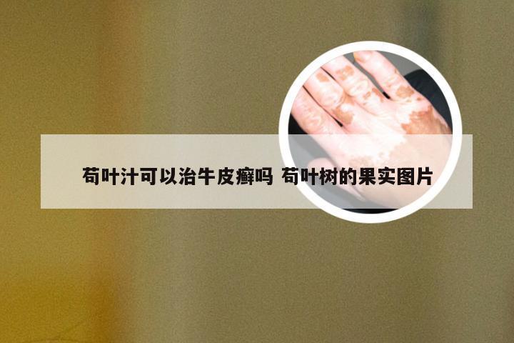 苟叶汁可以治牛皮癣吗 苟叶树的果实图片