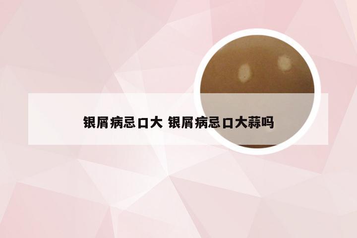 银屑病忌口大 银屑病忌口大蒜吗