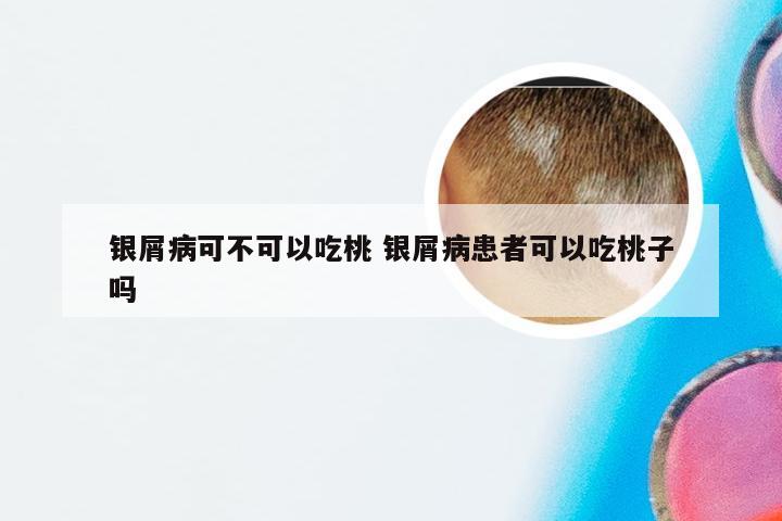 银屑病可不可以吃桃 银屑病患者可以吃桃子吗