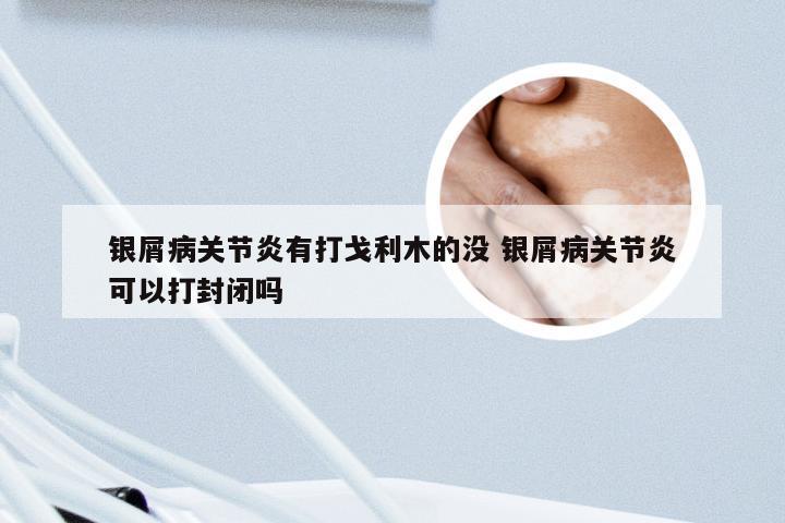 银屑病关节炎有打戈利木的没 银屑病关节炎可以打封闭吗