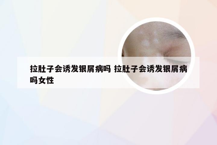 拉肚子会诱发银屑病吗 拉肚子会诱发银屑病吗女性