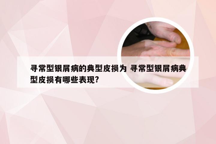 寻常型银屑病的典型皮损为 寻常型银屑病典型皮损有哪些表现?