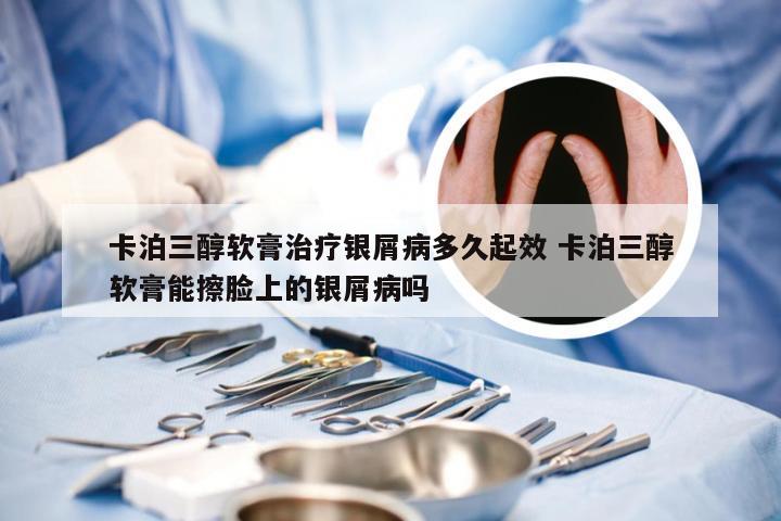 卡泊三醇软膏治疗银屑病多久起效 卡泊三醇软膏能擦脸上的银屑病吗