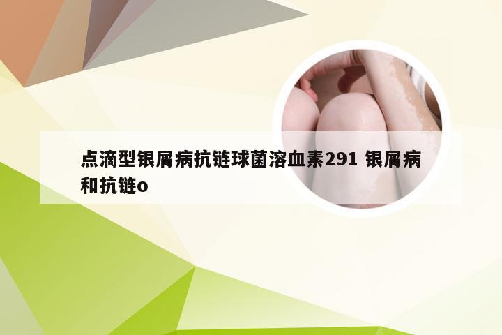 点滴型银屑病抗链球菌溶血素291 银屑病和抗链o
