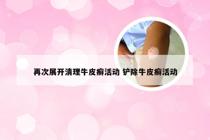 再次展开清理牛皮癣活动 铲除牛皮癣活动