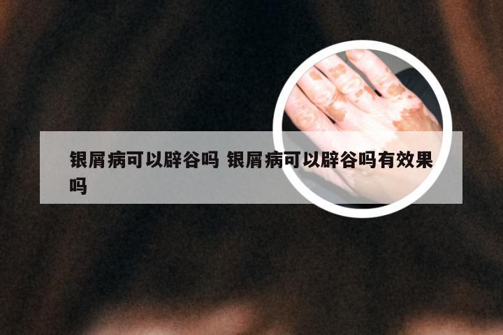 银屑病可以辟谷吗 银屑病可以辟谷吗有效果吗