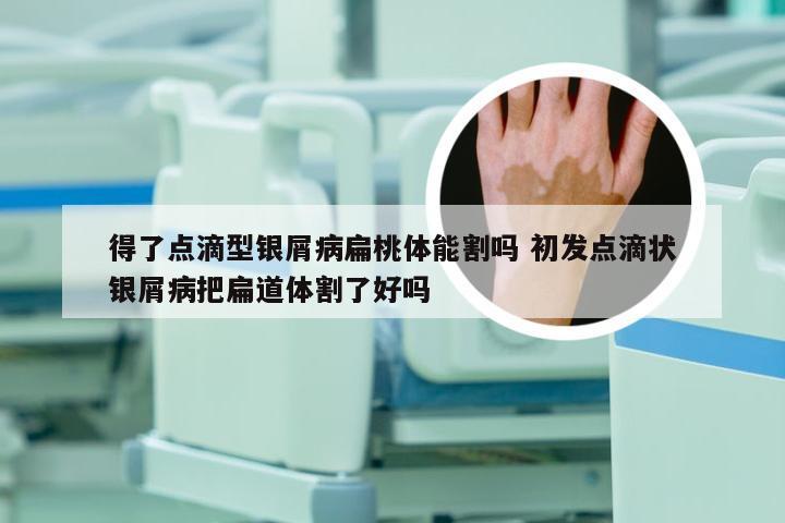 得了点滴型银屑病扁桃体能割吗 初发点滴状银屑病把扁道体割了好吗