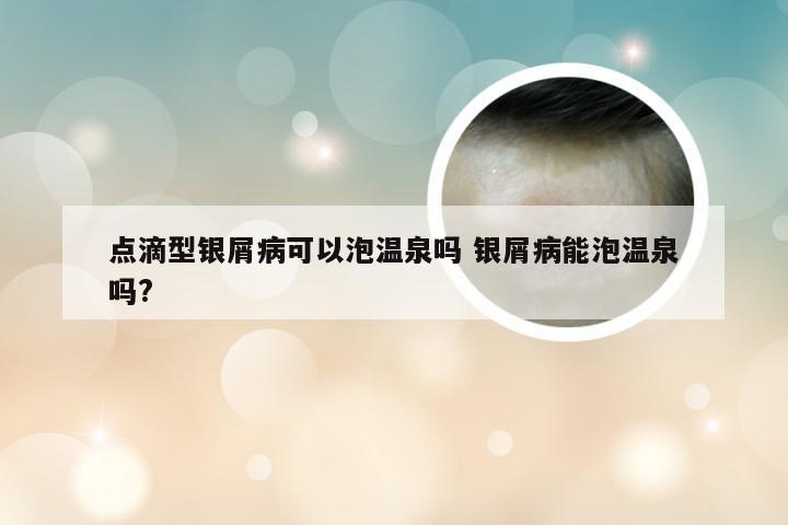 点滴型银屑病可以泡温泉吗 银屑病能泡温泉吗?
