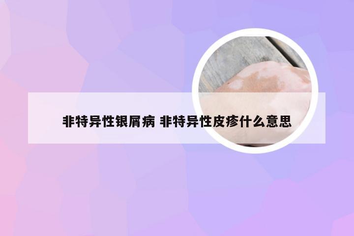 非特异性银屑病 非特异性皮疹什么意思