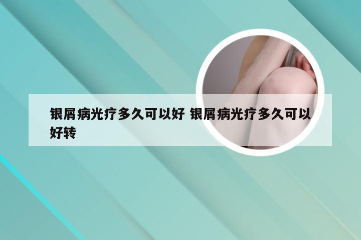 银屑病光疗多久可以好 银屑病光疗多久可以好转