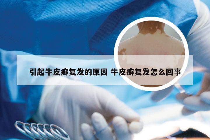 引起牛皮癣复发的原因 牛皮癣复发怎么回事