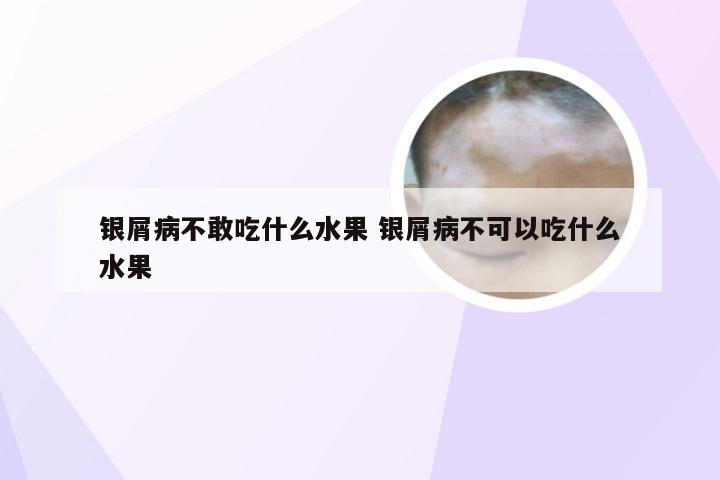 银屑病不敢吃什么水果 银屑病不可以吃什么水果